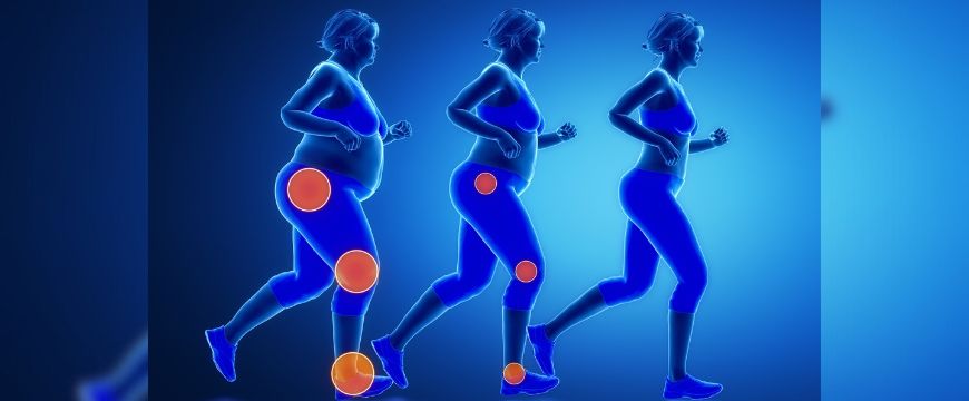 AN UNENDING CONNECTION BETWEEN OBESITY AND JOINT PAIN
