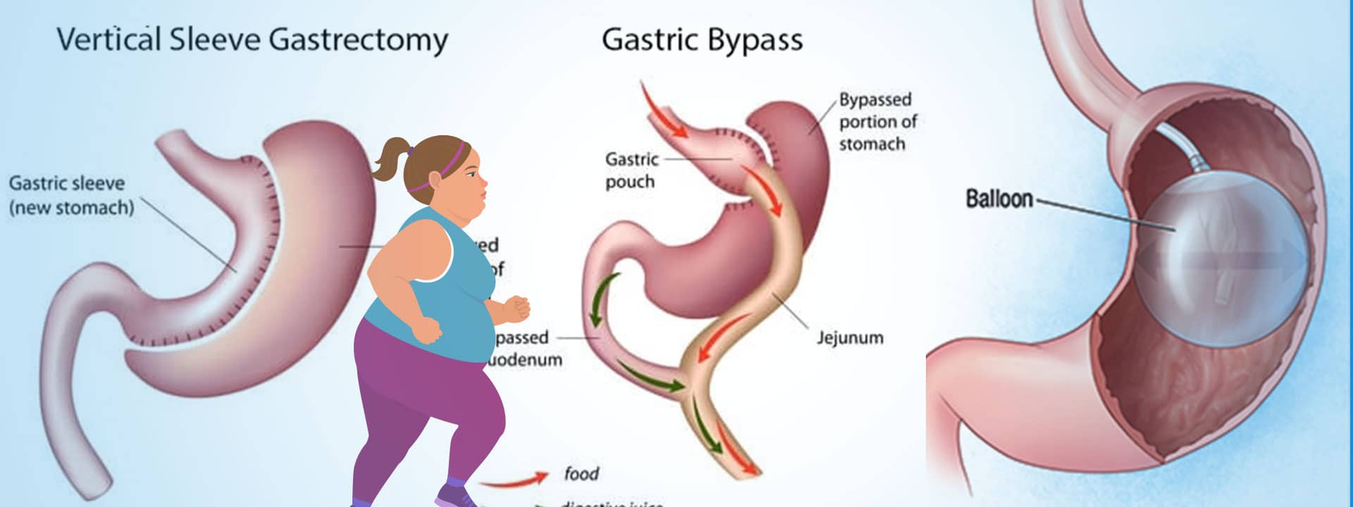 Best Gastric Surgeon in Dwarka, West Delhi