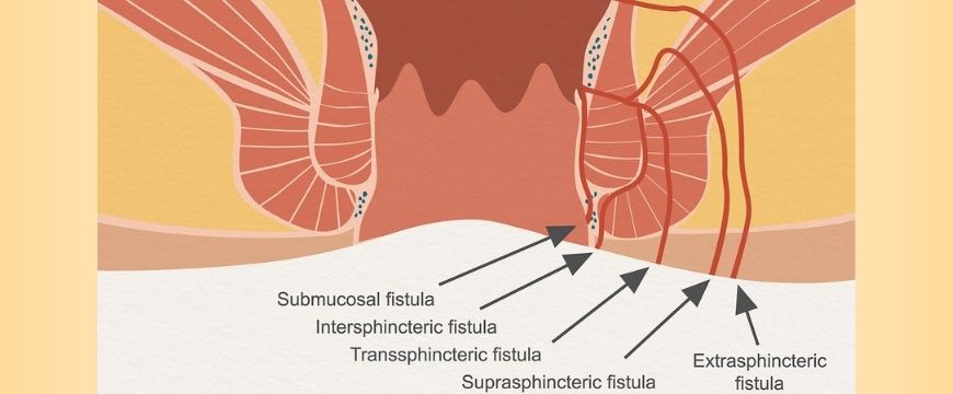 ANAL PROBLEMS & Throat Concerns