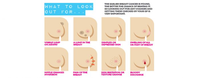 Breast Cancer Surgeon