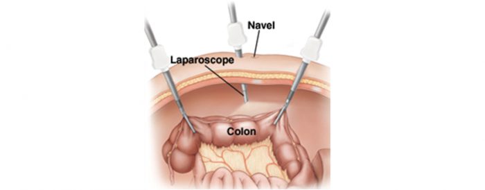 Colorectal Surgeon