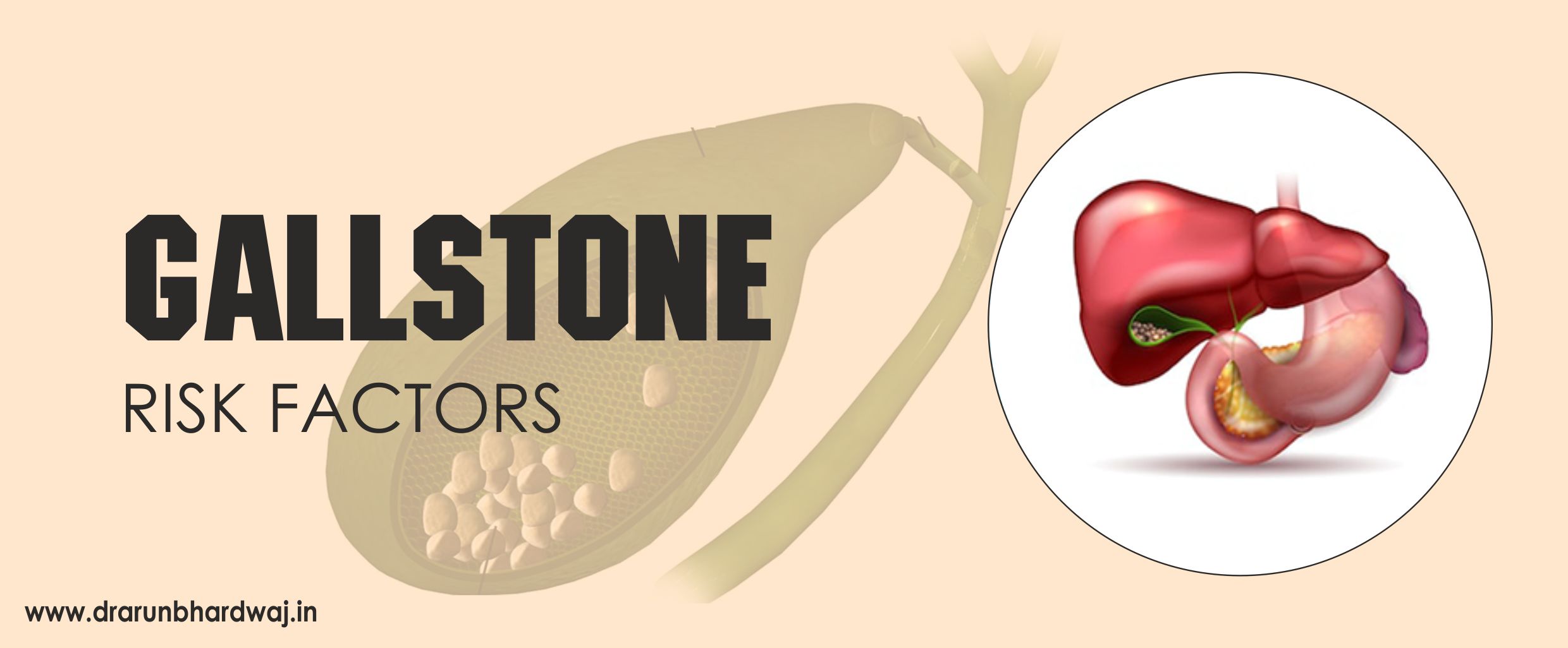 GALLSTONES: FACTORS RESPONSIBLE FOR GALLSTONES