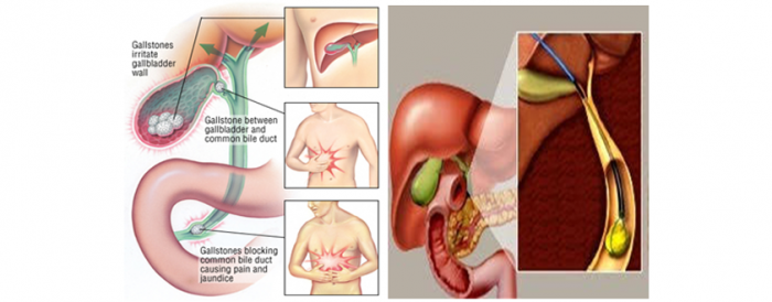 Best Laparoscopic surgen in delhi