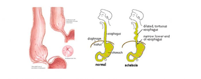 Best Laparoscopic surgen in delhi