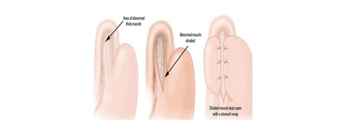 Best Laparoscopic surgen in delhi