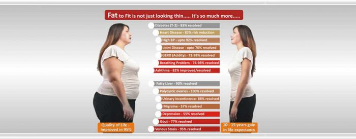 Best Weight Loss Surgeon in Delhi NCR